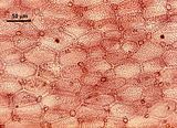 3 - Cellule corticali in visione superficiale